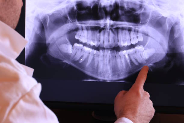 Best Urgent Care for Lost Fillings or Crowns in Fletcher, OK