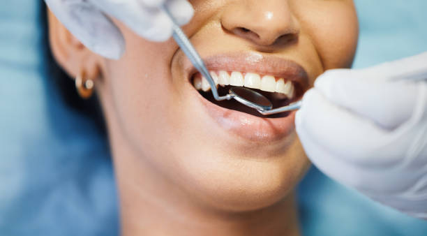 Best Emergency Treatment for Dental Infections or Abscesses in Fletcher, OK