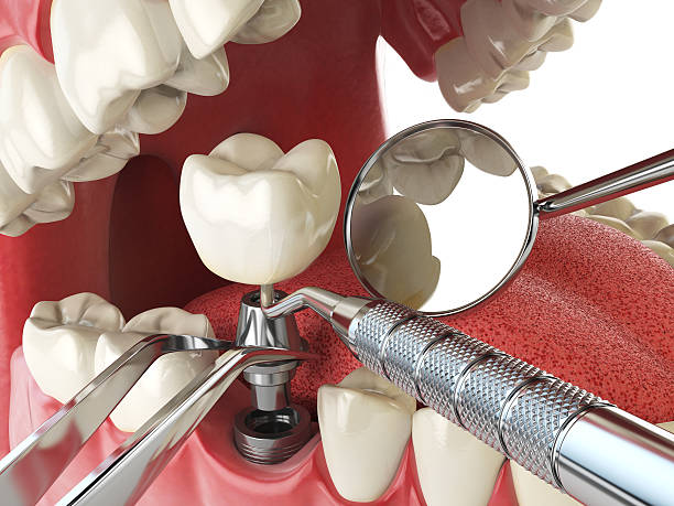 Best Emergency TMJ Treatment in Fletcher, OK