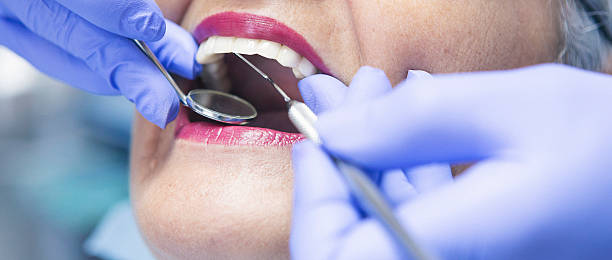 Best Emergency Treatment for Dental Infections or Abscesses in Fletcher, OK